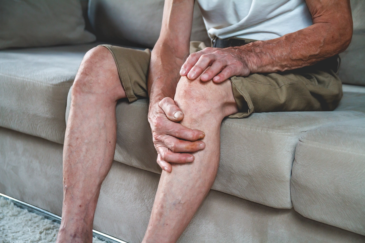 Il rituale serale per gambe leggere in estate: i consigli dei flebologi contro la ritenzione idrica Il rituale serale per gambe leggere in estate: i consigli dei flebologi contro la ritenzione idrica
